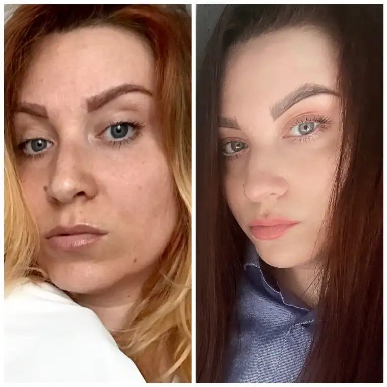 inner balance skin transformation before after natural glow