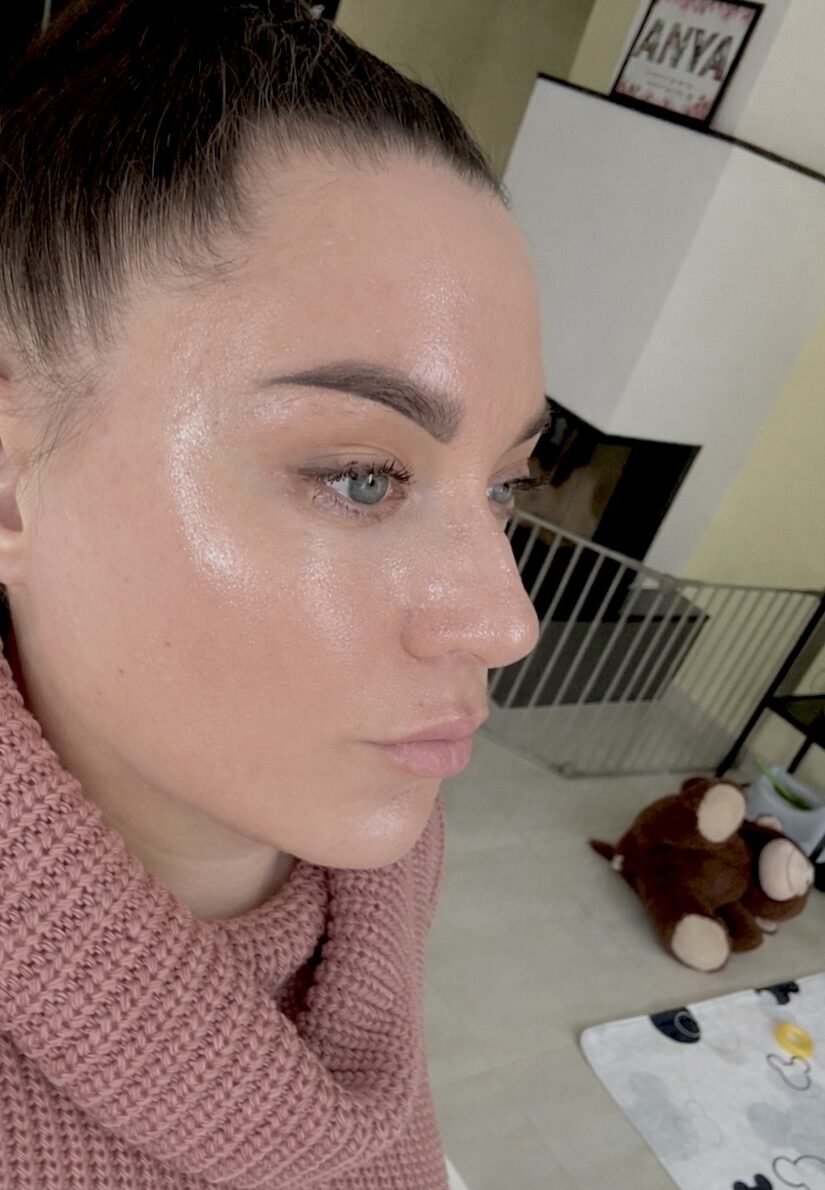 Healthy glowing sensitive skin supported by hydration and barrier-friendly skincare routine
