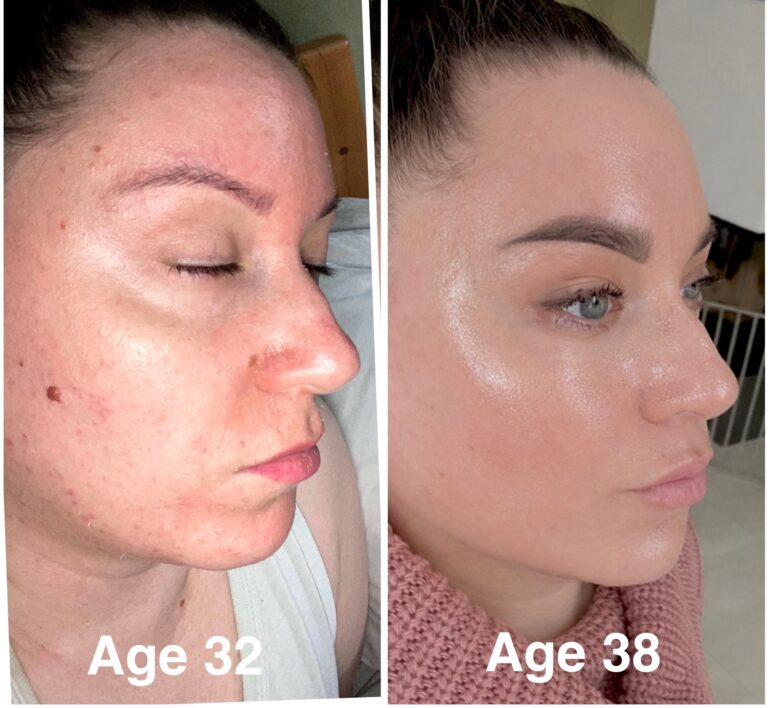 Simple Skin Longevity Routine for Sensitive Skin